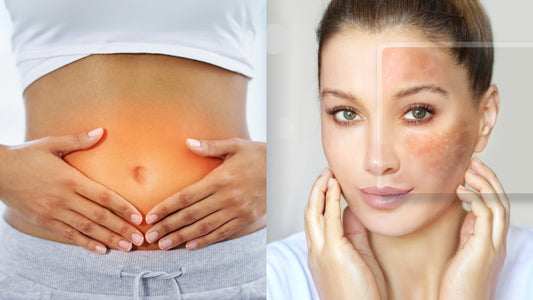 Woman with inflamed skin and stomach bloating, illustrating gut-skin connection and chronic inflammation; promotes Deos Co.'s clean skincare solutions.