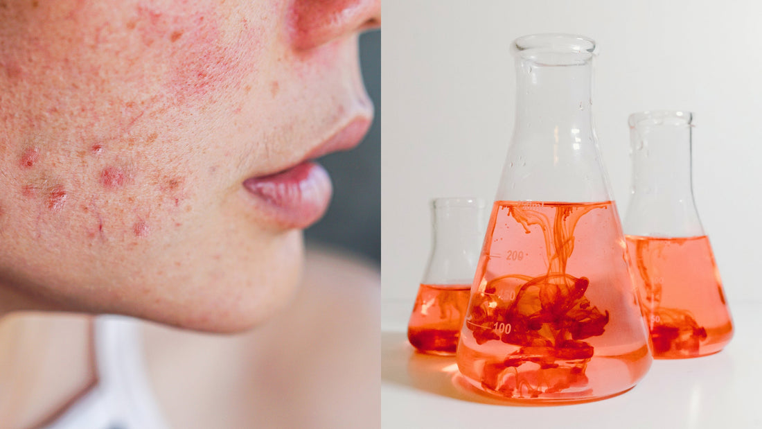 Is Your Soap Slowly Poisoning You? The Frightening Truth About Artificial Fragrances and Dyes