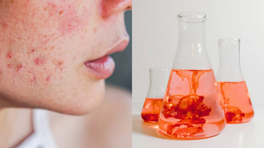 Is Your Soap Slowly Poisoning You? The Frightening Truth About Artificial Fragrances and Dyes